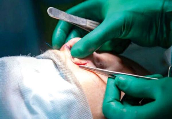 افزایش تمایل به جراحی زیبایی بین نوجوانان ۱۴ تا ۱۸ سال افزایش تمایل به جراحی زیبایی بین نوجوانان ۱۴ تا ۱۸ سال