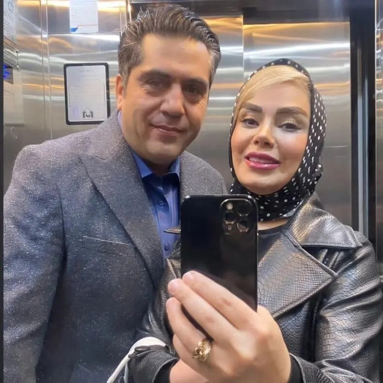 تغییر چهره صبا راد با عمل های زیبایی+ عکس تغییر چهره صبا راد با عمل های زیبایی+ عکس