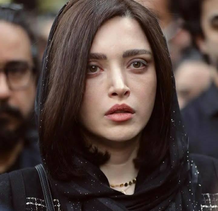 تغییر چهره عجیب بهنوش طباطبایی با عمل زیبایی+ عکس تغییر چهره عجیب بهنوش طباطبایی با عمل زیبایی+ عکس