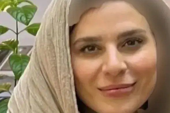 تغییر چهره سحر دولتشاهی بعد علنی شدن ازدواجش با همایون/عکس تغییر چهره سحر دولتشاهی بعد علنی شدن ازدواجش با همایون/عکس