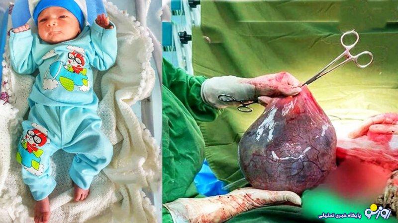 عجیبترین زایمانها در ایران/ از زایمان در مترو و تاکسی تا قایق و هلیکوپتر! عجیبترین زایمانها در ایران/ از زایمان در مترو و تاکسی تا قایق و هلیکوپتر!