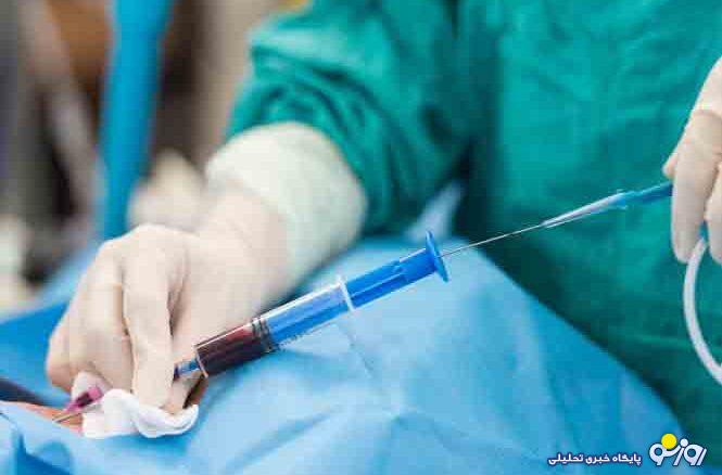 آنژیوگرافی قلب چیست و چگونه انجام می‌شود؟